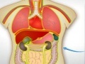 Elundisiirdamine 2, et mängida online